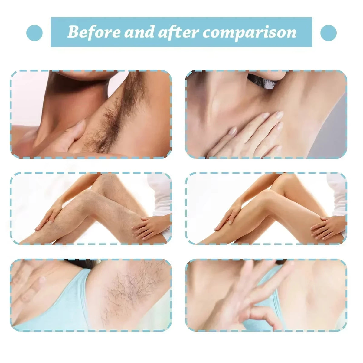 Permanent Hair Inhibition Serum Painless Allantoin Lupine Essence Hair Remover Hair Growth Inhibitor Depilatory Body Cream Care